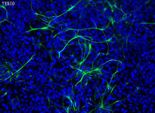 人神經幹細胞
