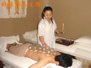 《拔罐》 《拔罐》