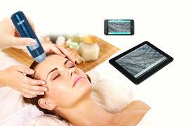 毛髮檢測儀 毛髮檢測儀