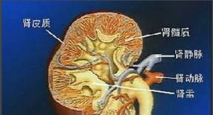 系統性紅斑狼瘡性腎炎