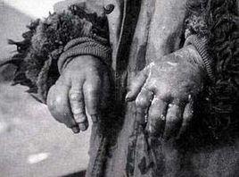 細菌試驗 細菌試驗