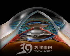 乾燥性角結膜炎 乾燥性角結膜炎