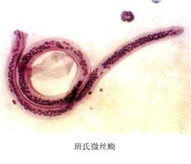 班氏吳策線蟲 班氏吳策線蟲