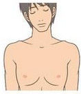 男性乳腺發育症 男性乳腺發育症
