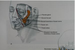 頰脂墊在臉部的位置