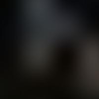 IC 654 RASS 彩色圖