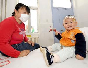 腸道病毒(EV71) 腸道病毒(EV71)