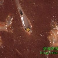 抗體滴度 抗體滴度