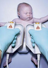 新生兒呼吸暫停 新生兒呼吸暫停