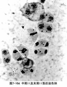 落後染色體 落後染色體