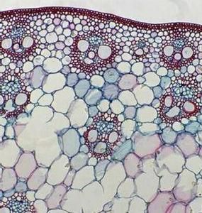霍奇金淋巴瘤 霍奇金淋巴瘤
