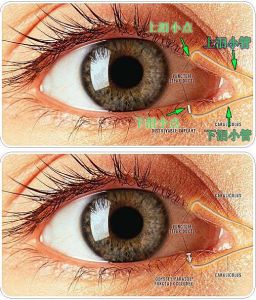 傳染性角膜炎 傳染性角膜炎