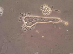 固著吸管蟲 固著吸管蟲