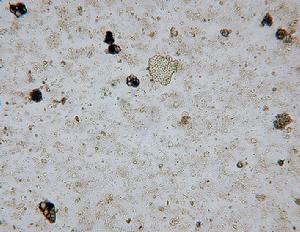 超微化石軟泥