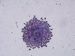 克隆細胞形成實驗