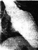 心臟造影 心臟造影