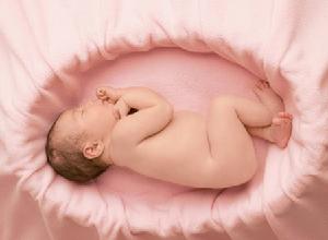 新生兒低鈉血症