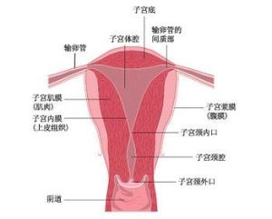 子宮內膜異位症