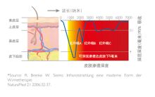飛利浦紅外線治療儀
