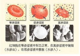 低滲溶液 低滲溶液
