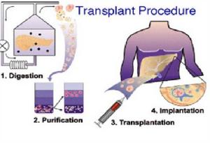 胰島移植中操作基本程