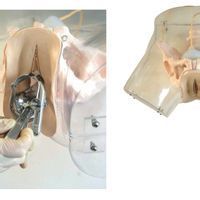 高危人流 高危人流